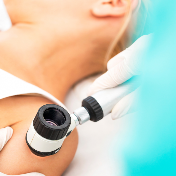 Dermatoskopia 